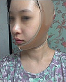 안면슈퍼 이미지