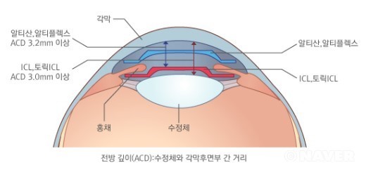 렌즈공간 이미지