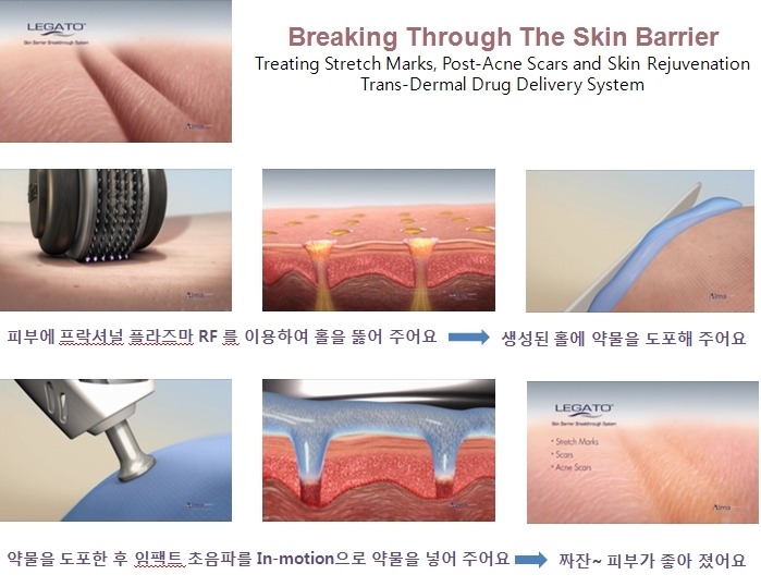 레가토 이미지