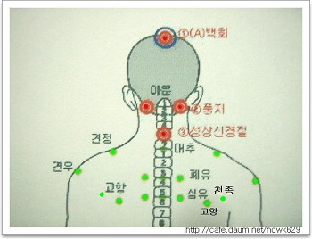 자연정혈요법 이미지