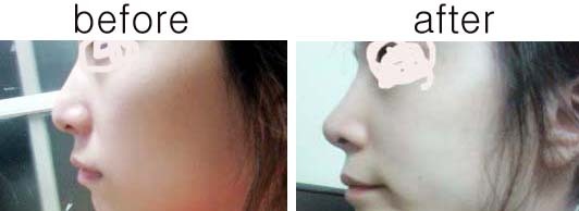 아름다운성형외과 이미지