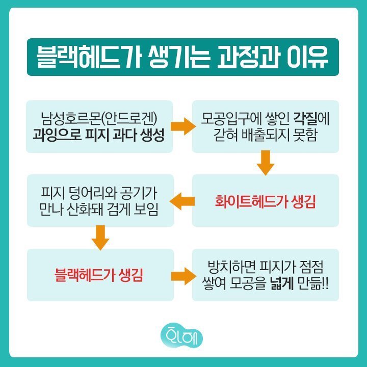 블랙헤드 제거하는 방법 5단계 | 인스티즈