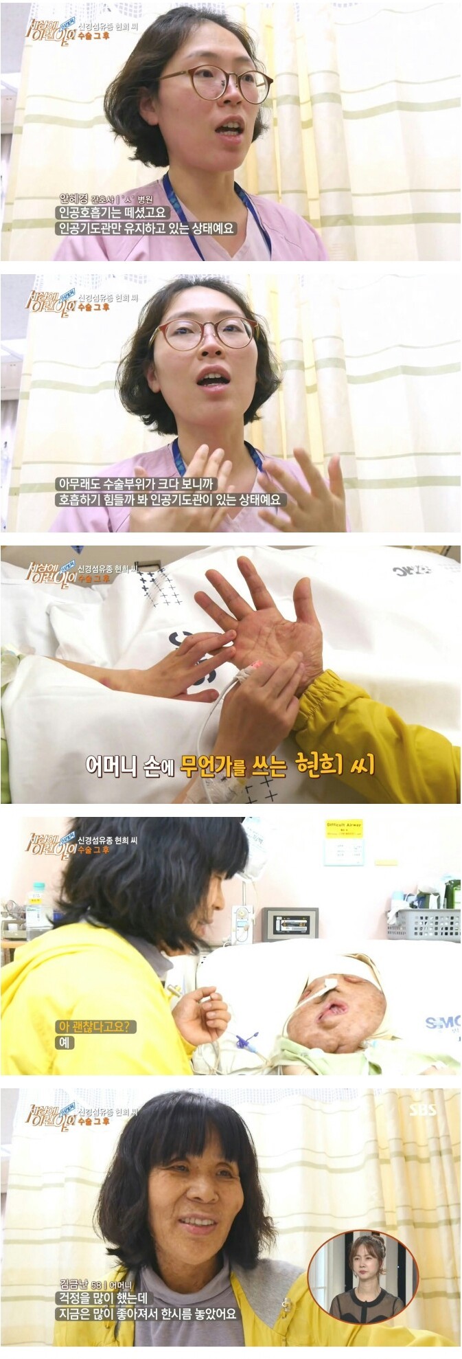  sbs 세상에 이런 일이 현희씨 수술 그 후.jpg | 인스티즈