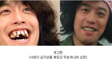 일본인 치아 | 인스티즈