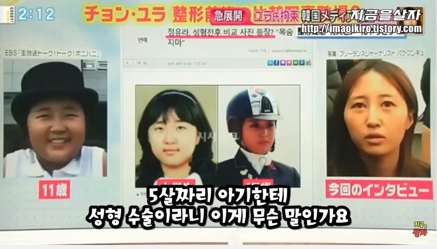 일본에서 한국인들 성형 많이한다고 낙인찍힘.jpg | 인스티즈