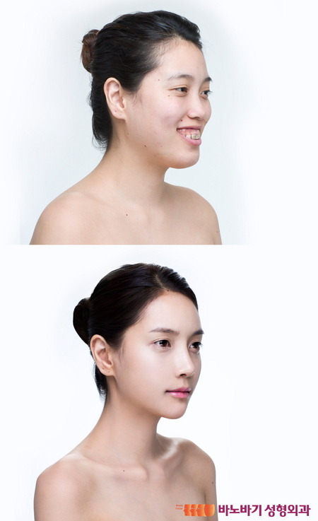 렛미인 이미지