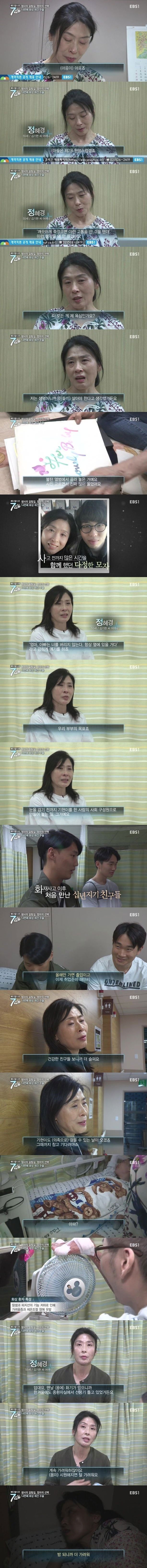 화상 환자들이 겪는 고통.jpg | 인스티즈