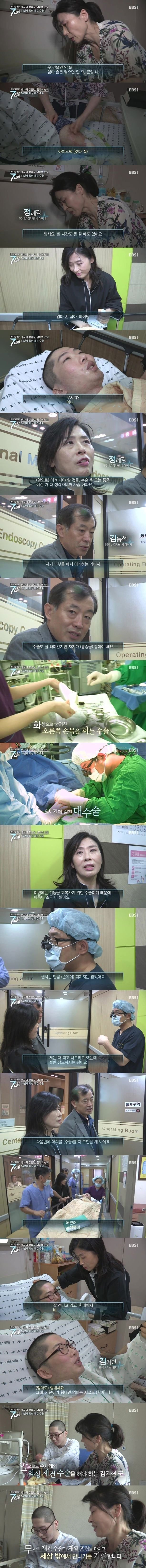 화상 환자들이 겪는 고통.jpg | 인스티즈
