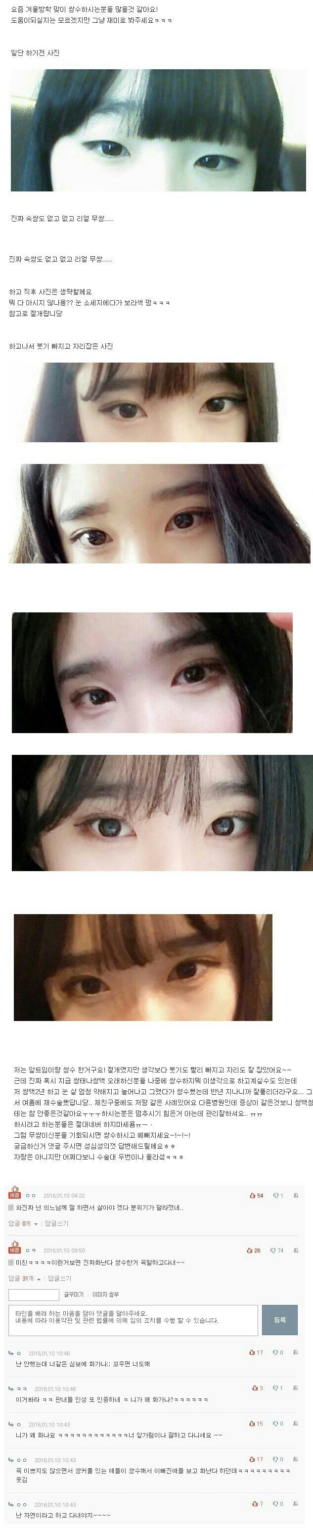 대박난 쌍꺼플수술녀 | 인스티즈